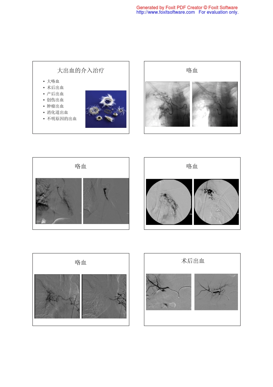 介入治疗在急诊的应用_第2页