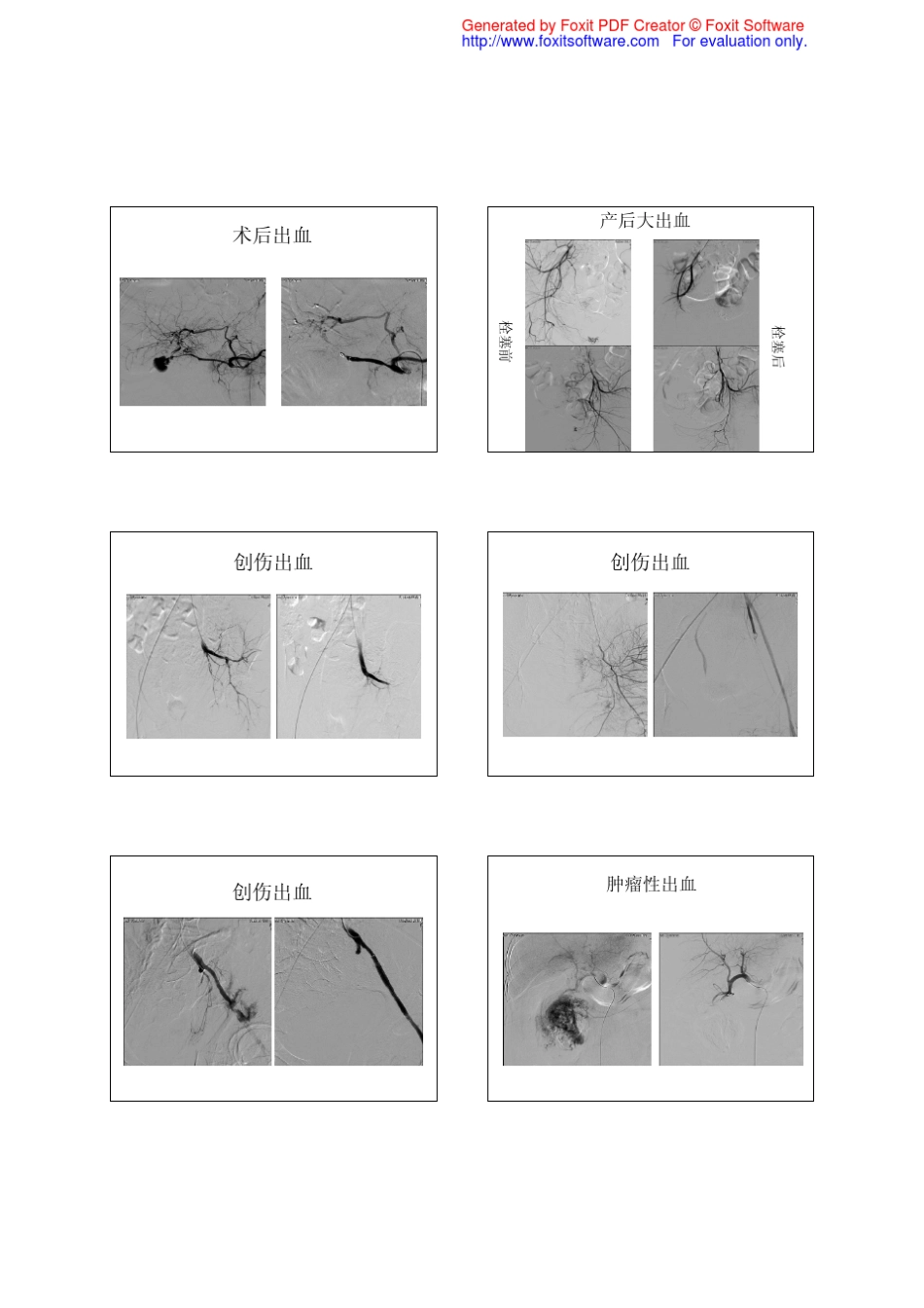 介入治疗在急诊的应用_第3页