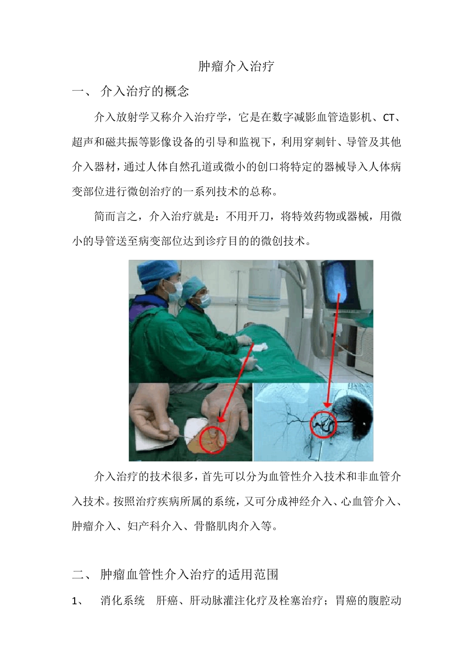 介入治疗肿瘤_第1页