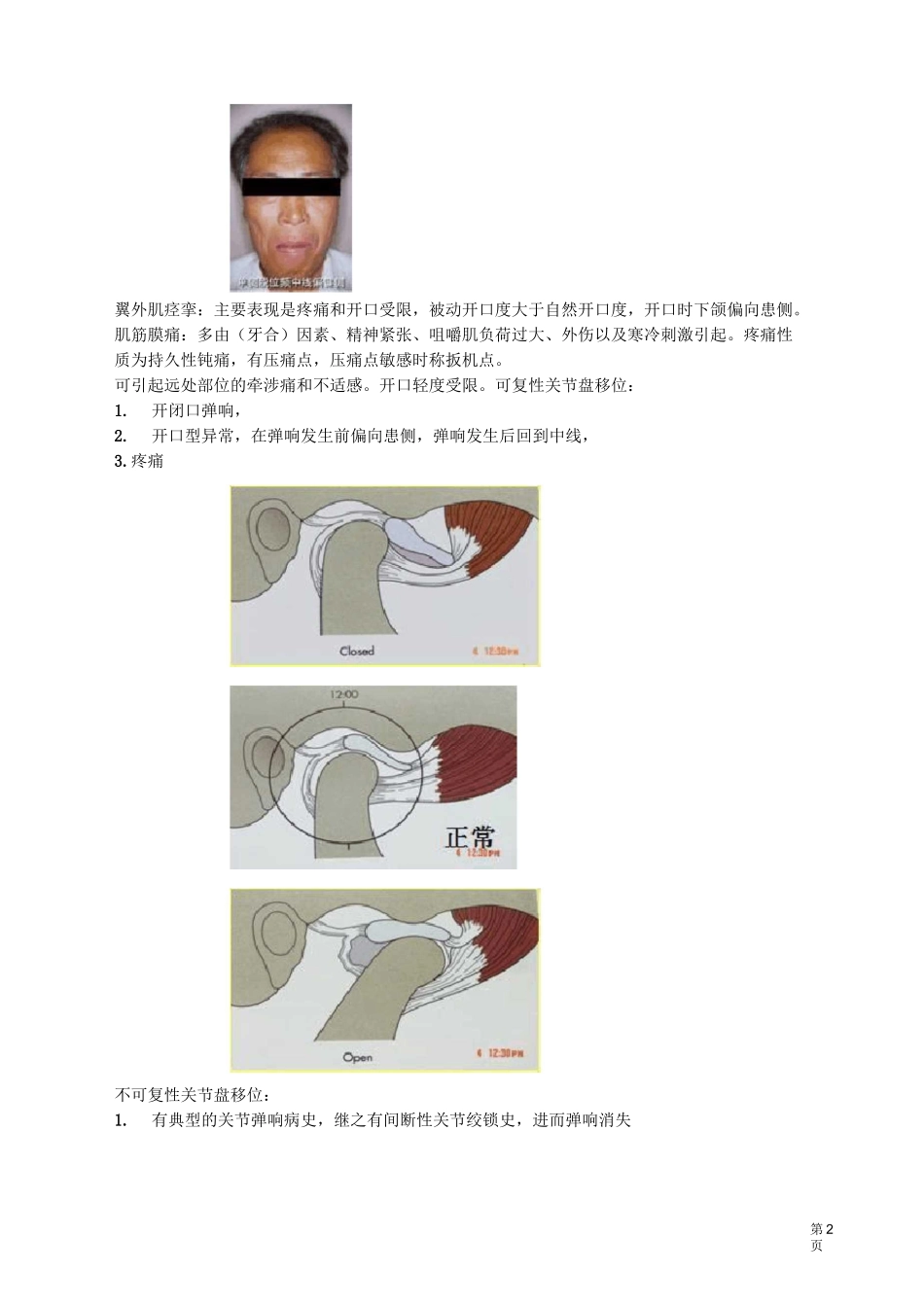 口腔医师-颞下颌关节疾病讲义_第2页