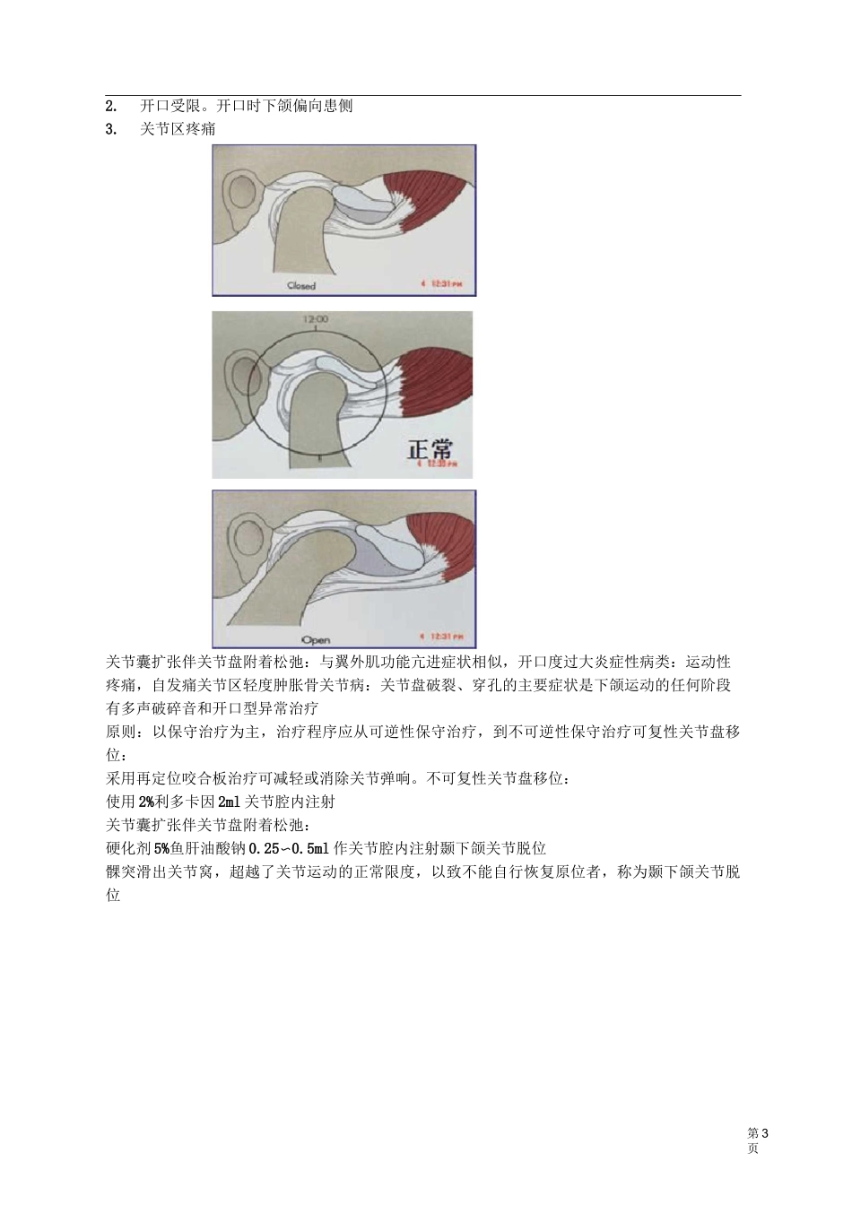 口腔医师-颞下颌关节疾病讲义_第3页