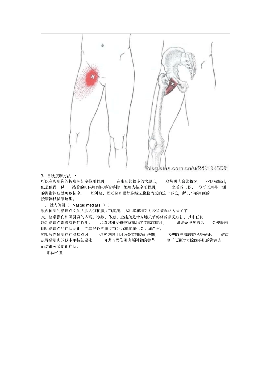 激痛点和肌肉疼痛自我按摩治疗大腿内侧痛_第3页