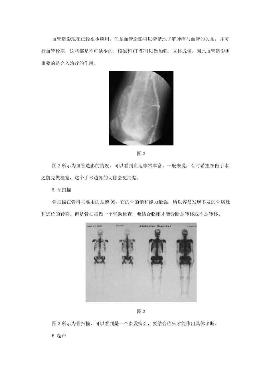 北京积水潭医院骨肿瘤科蔡槱伯_第3页