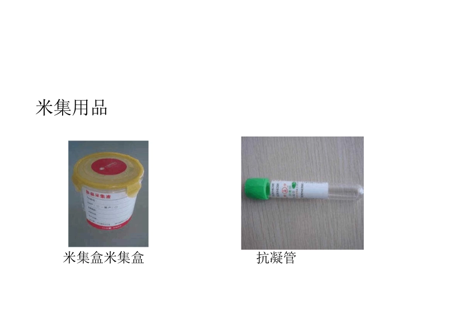 脐带胎盘干细胞采集流程_第1页