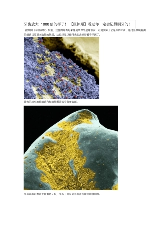 牙齿放大1000倍的样子!【巨惊爆】看过你一定会记得刷牙的!