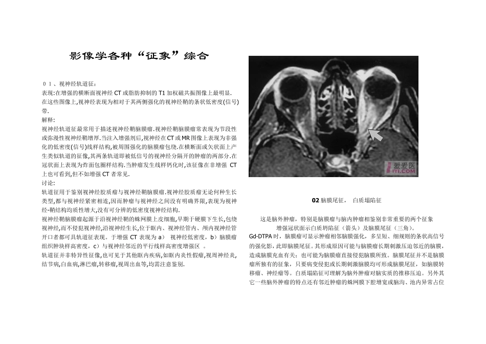 医学影像学各种“征象”综合_第1页