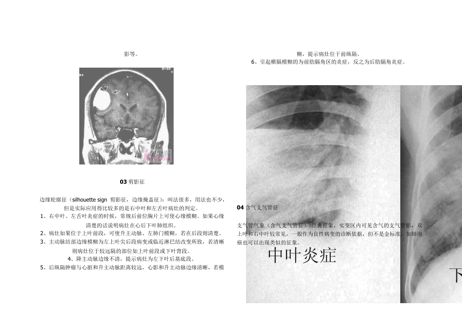 医学影像学各种“征象”综合_第2页