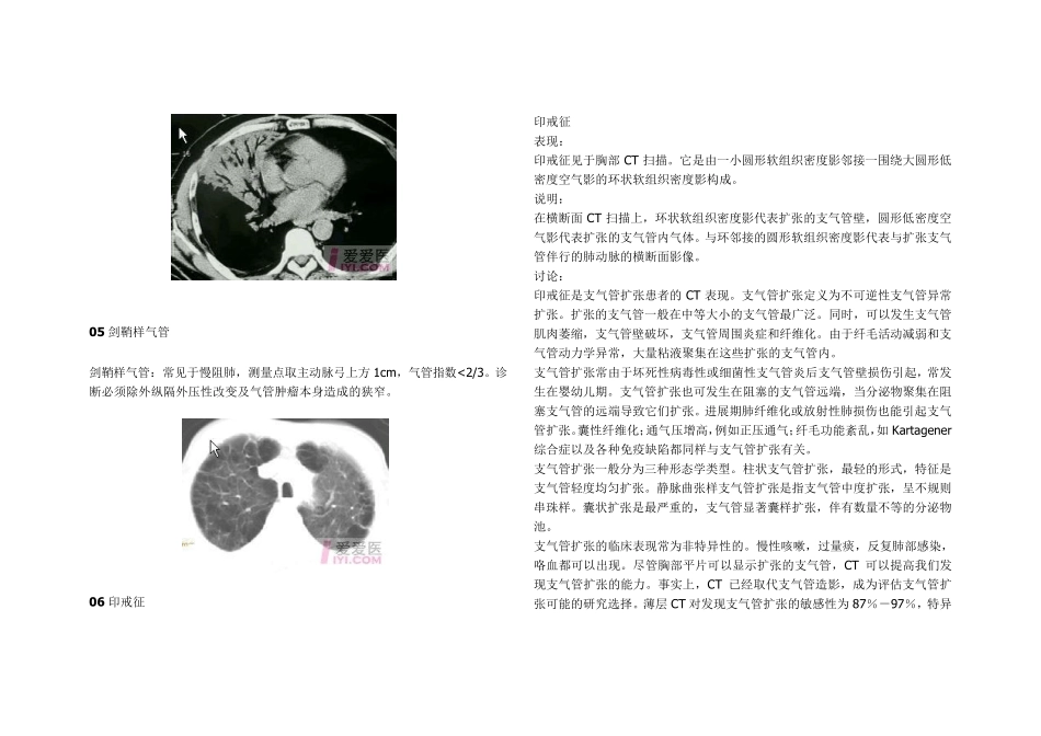 医学影像学各种“征象”综合_第3页