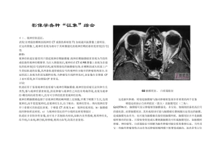 医学影像学各种“征象”综合