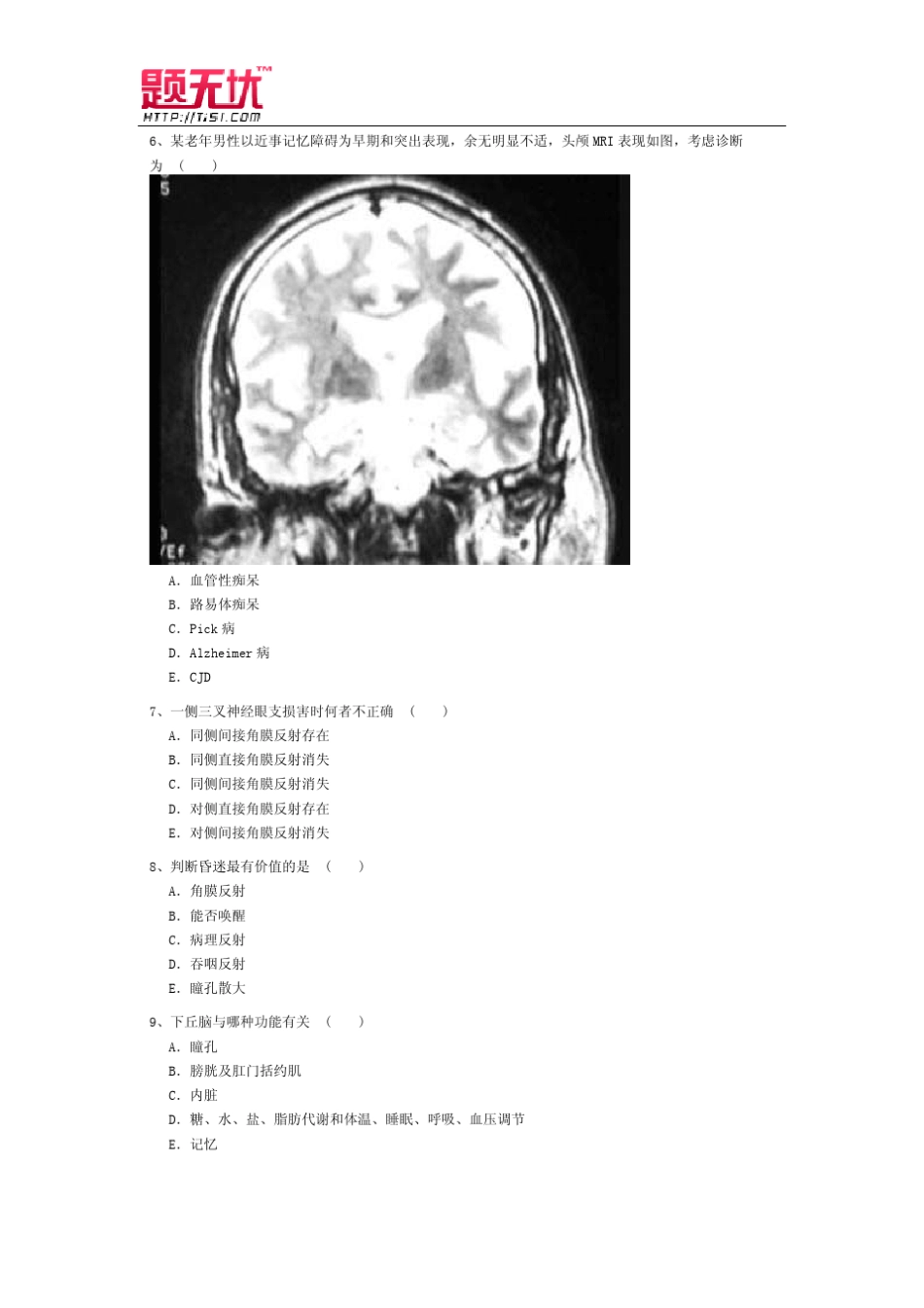 医学高级职称考试《神经内科》习题无忧_第2页