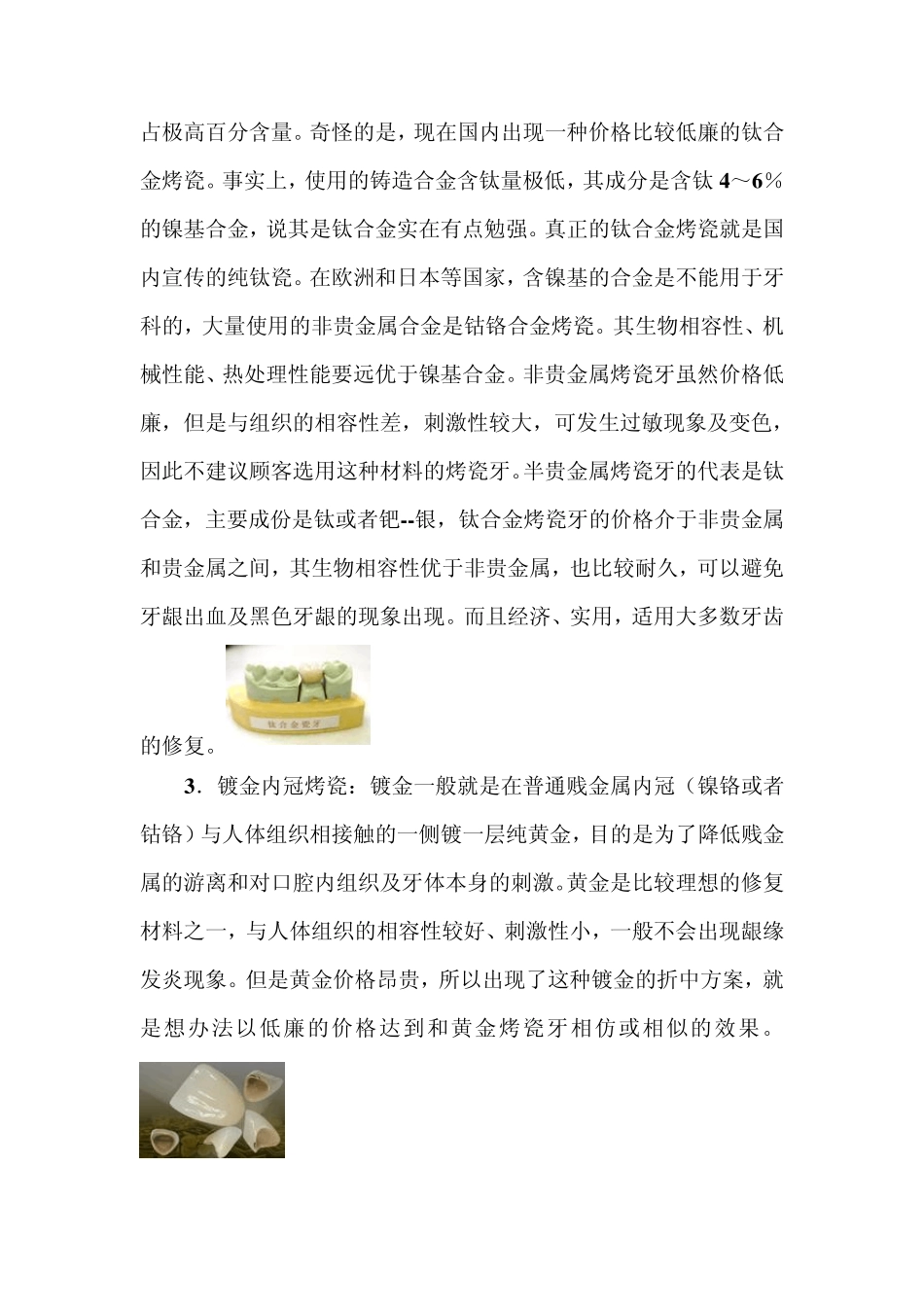 固定烤瓷牙全部资料_第2页
