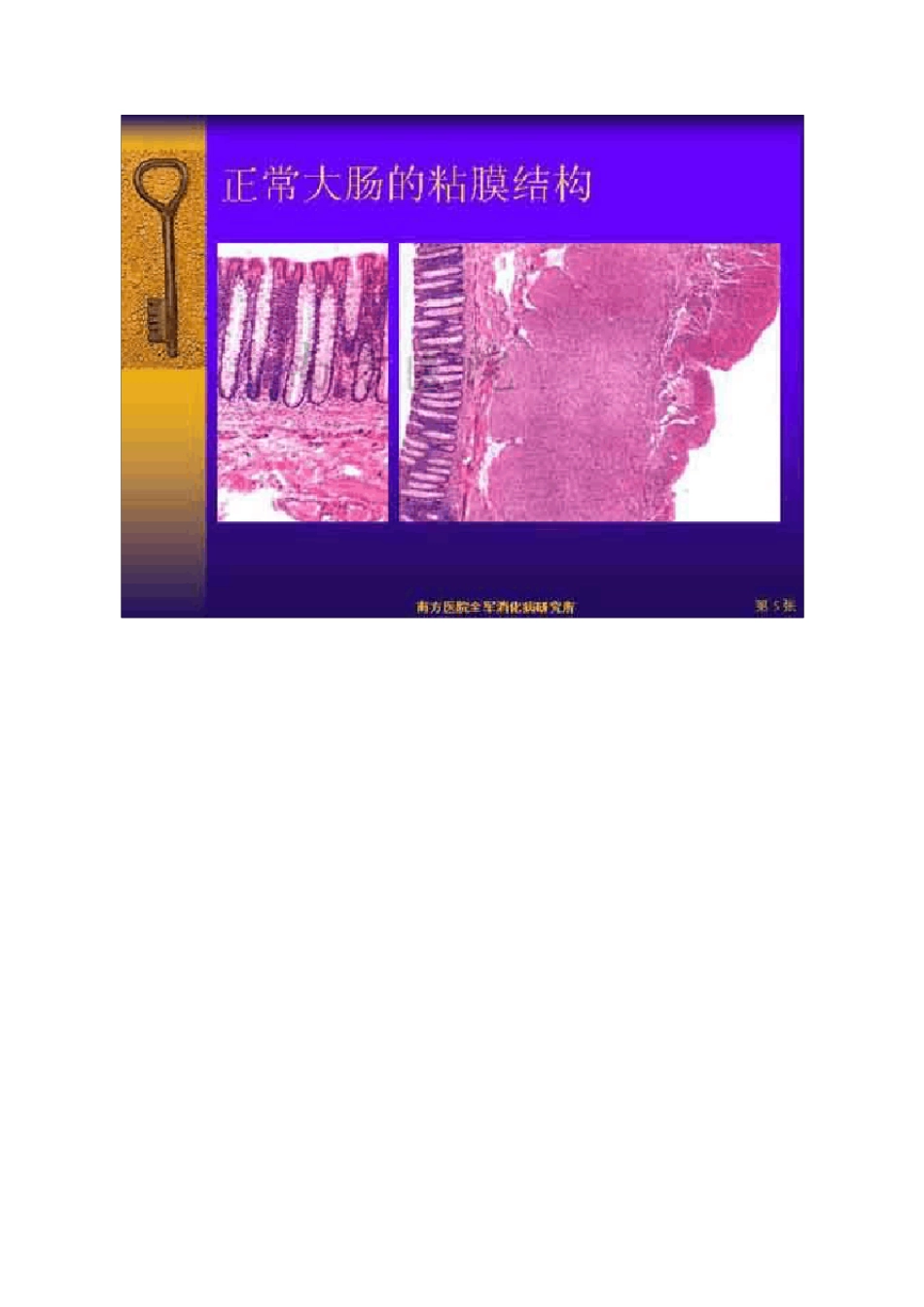 大肠pit分型及临床意义_第3页