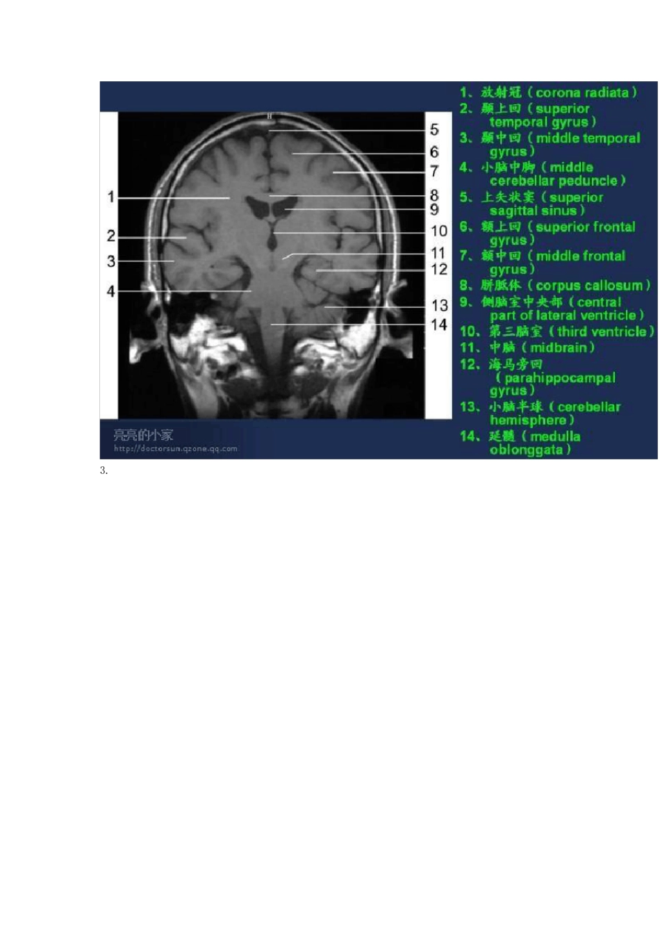头颅MRI(磁共振成像)断层图谱_第2页