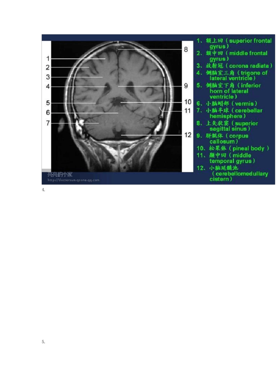 头颅MRI(磁共振成像)断层图谱_第3页