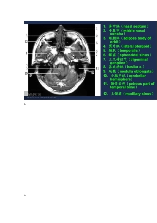 头颅MRI(磁共振成像)断层图谱