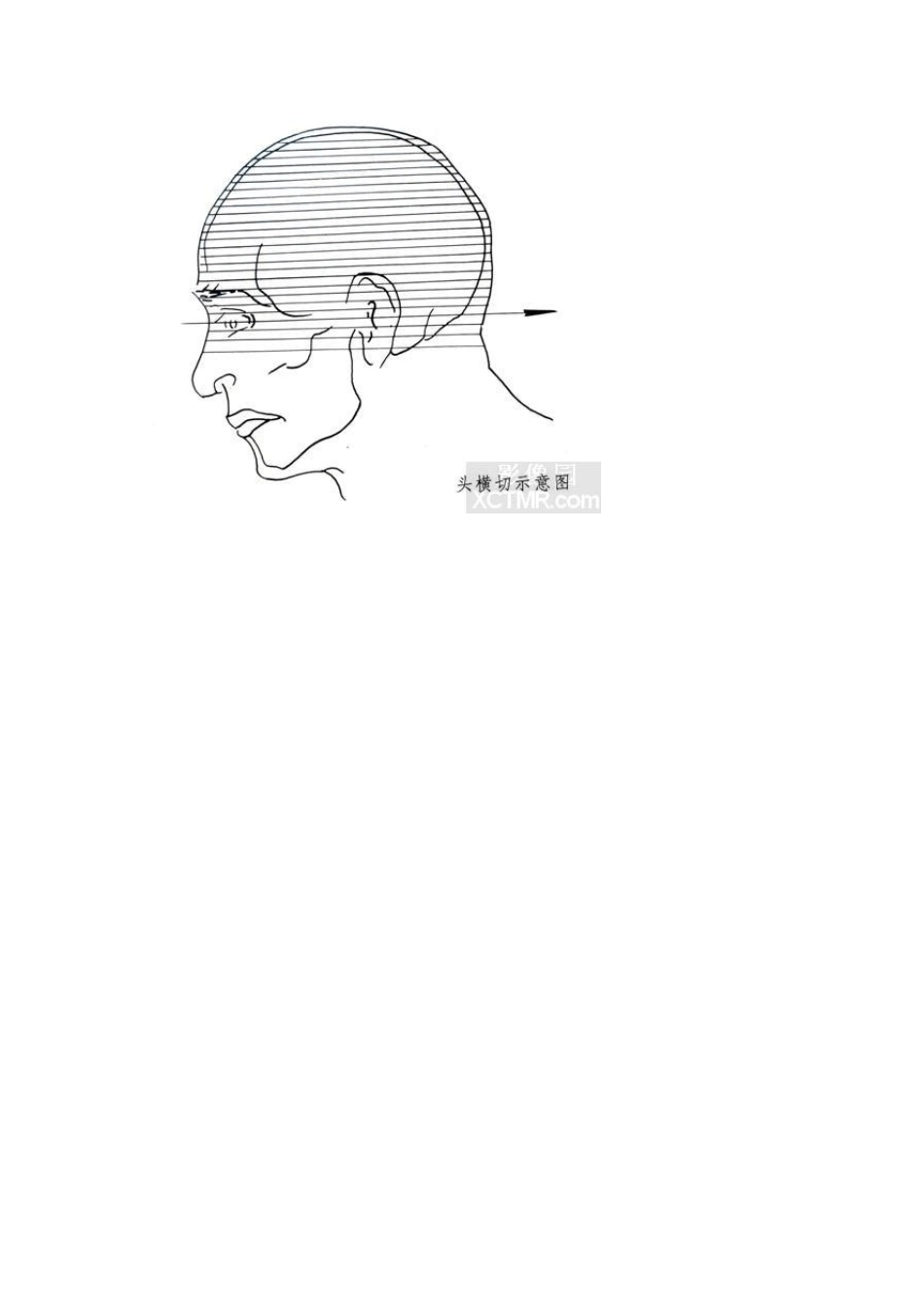 头颅横切面断层解剖_第1页
