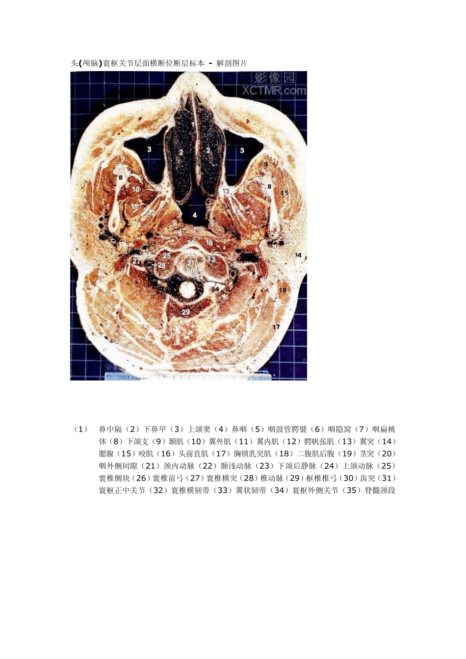 头颅横切面断层解剖_第2页