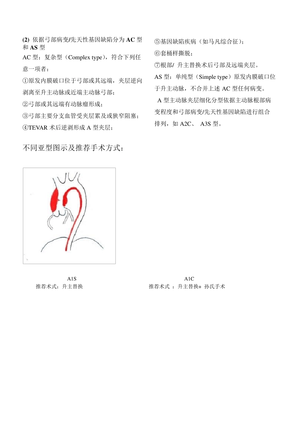 夹层分型及治疗方式_第2页