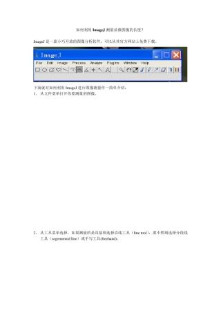 如何利用ImageJ测量显微图像的长度