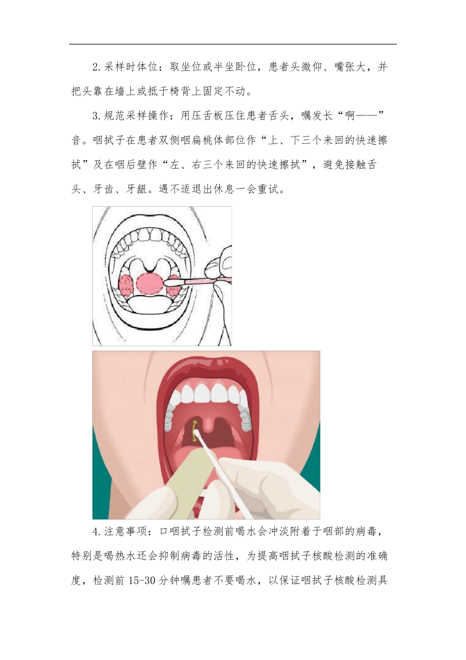 如何正确采集咽试子_第2页