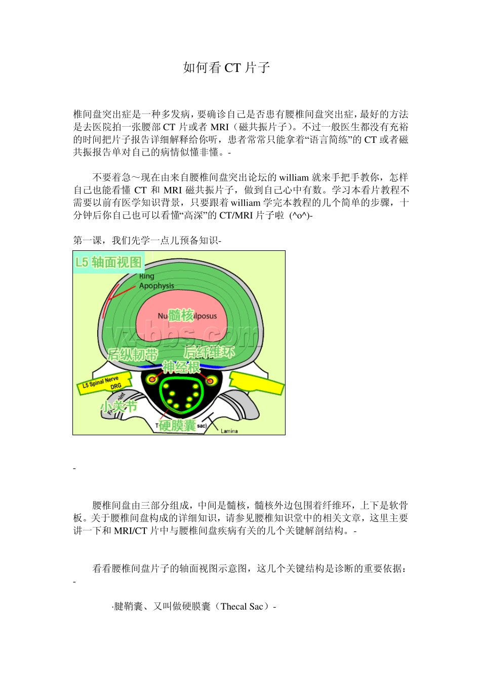 如何看CT片子_第1页