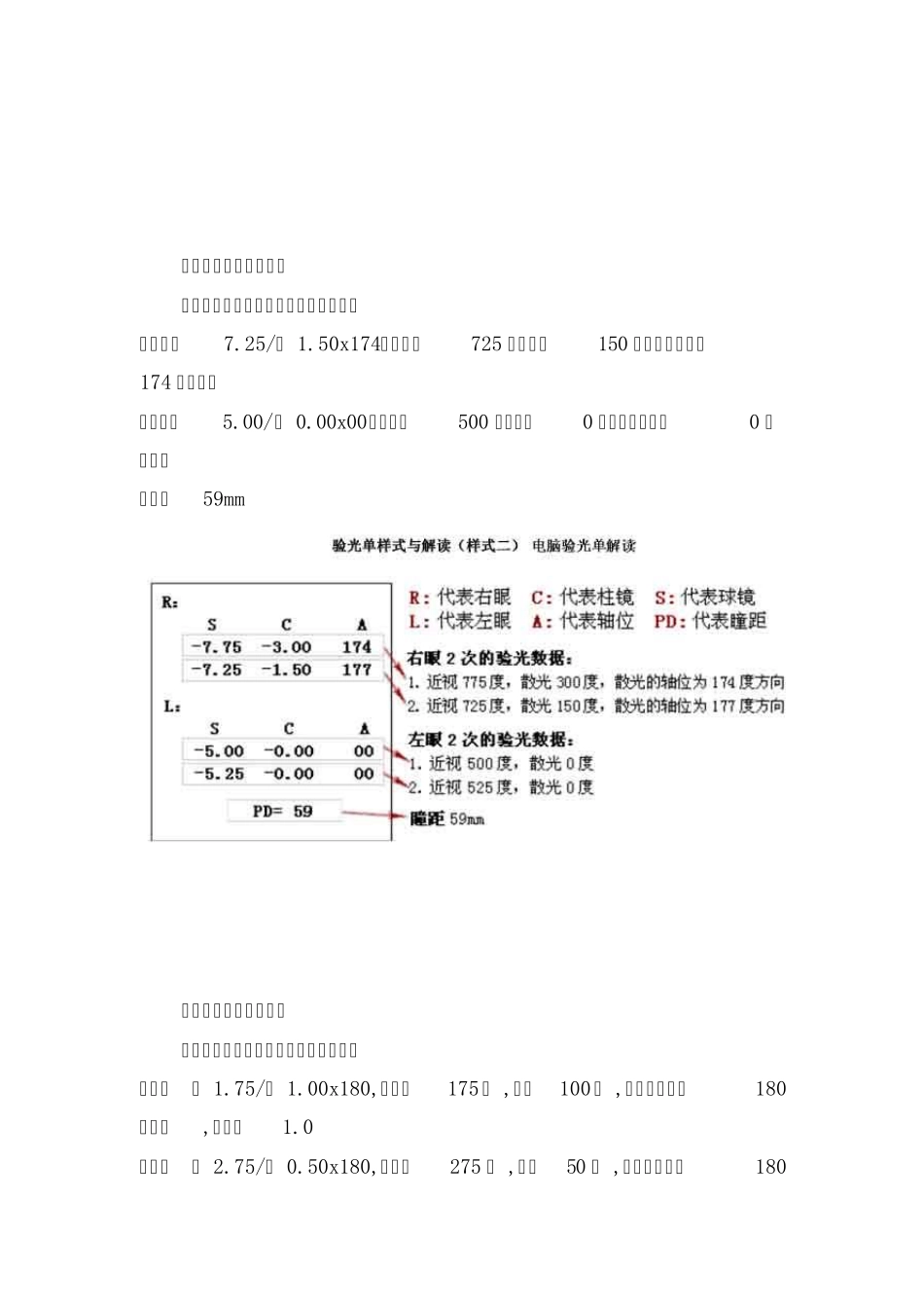 如何看验光数据_第2页