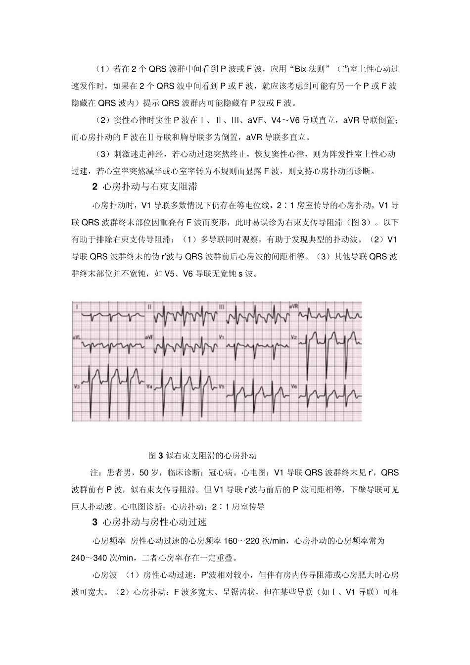 如何通过心电图“揪出”心房扑动？_第3页