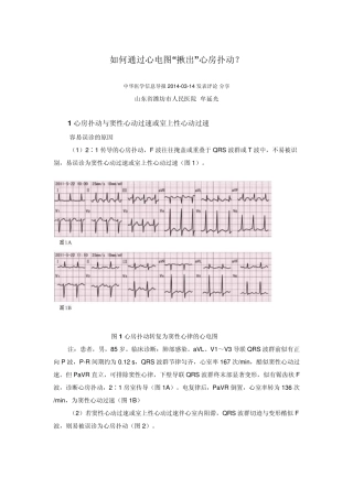 如何通过心电图“揪出”心房扑动？