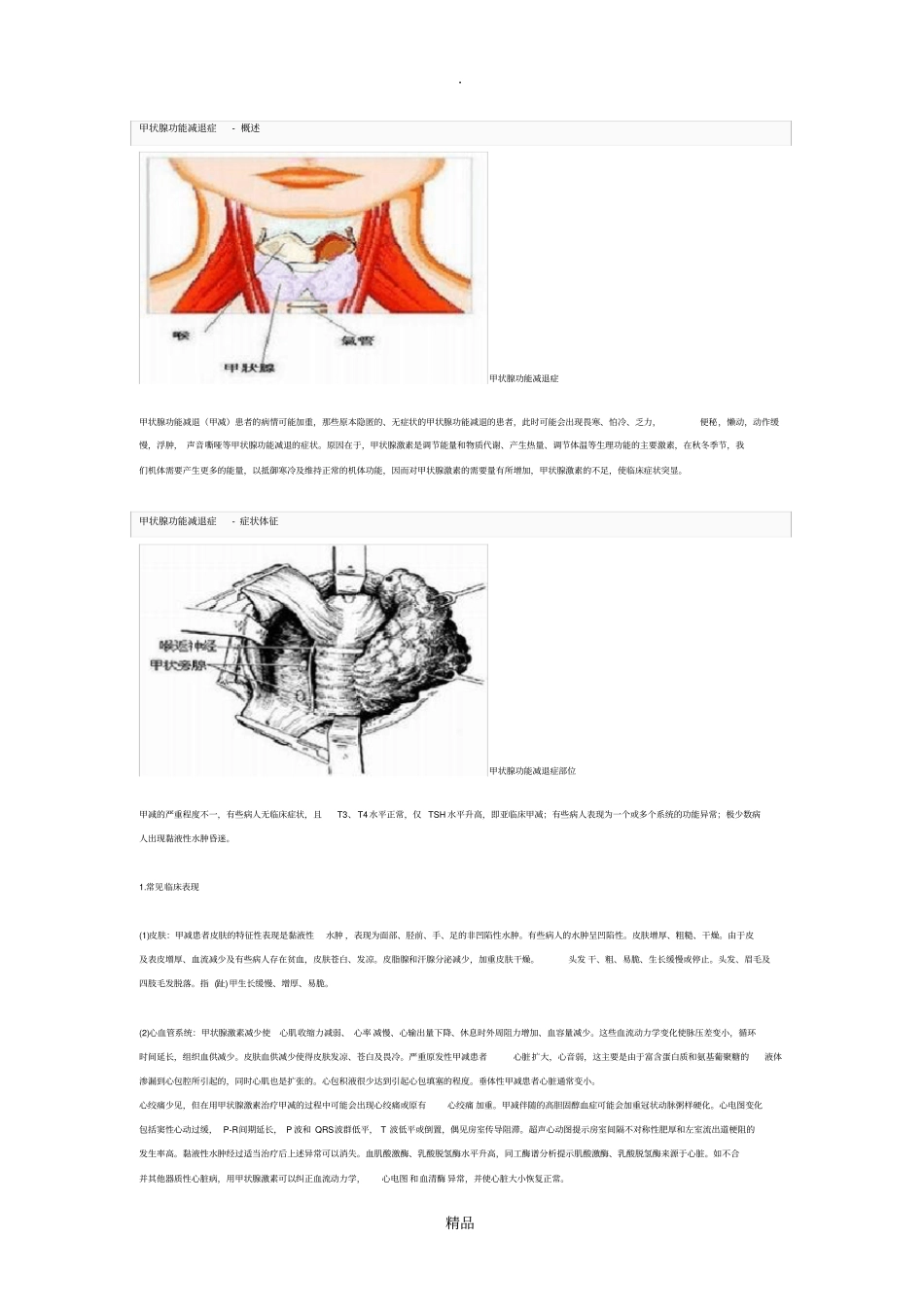 甲状腺功能减退症概述知识_第1页