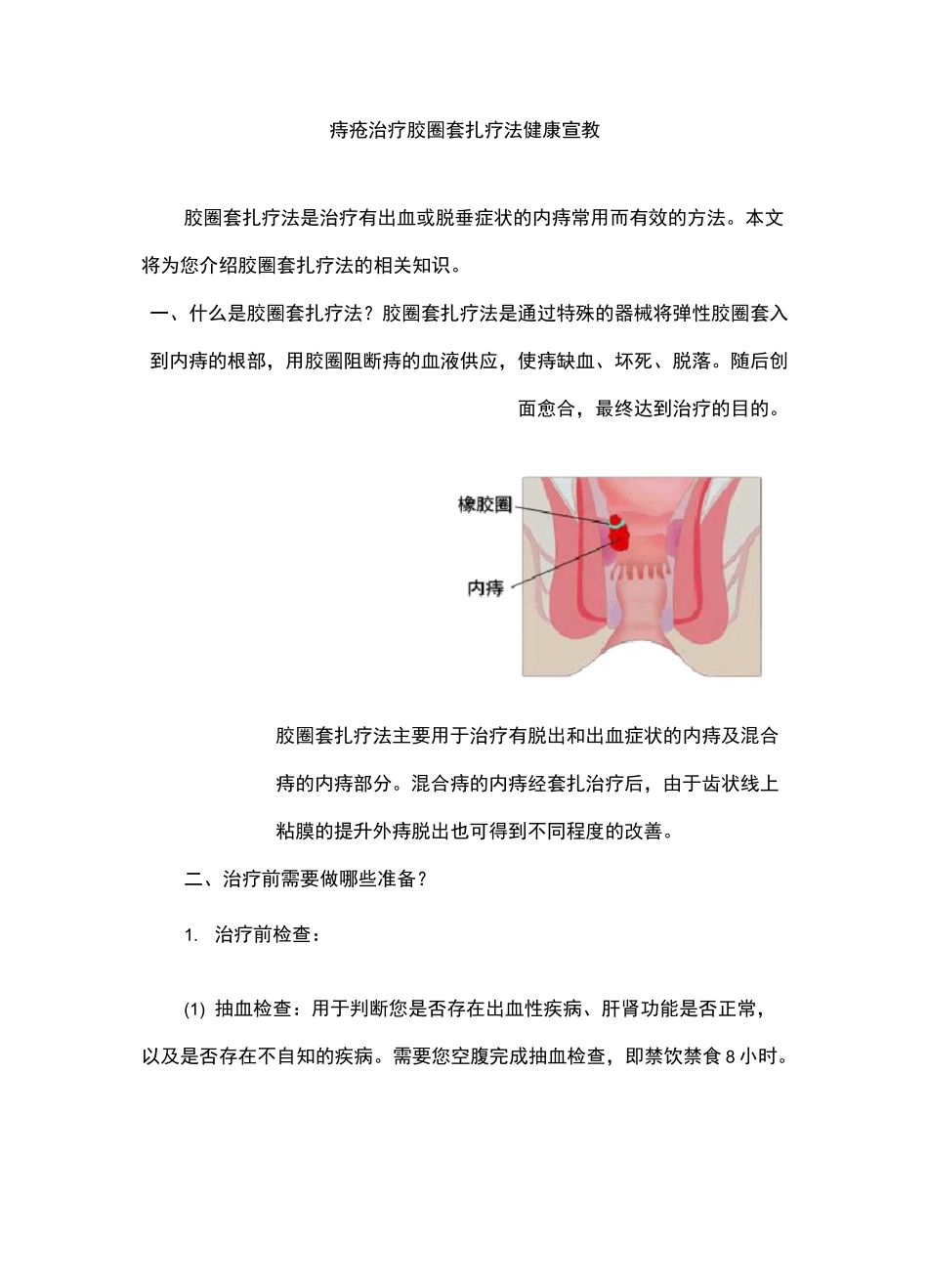 痔疮治疗胶圈套扎疗法健康宣教_第1页