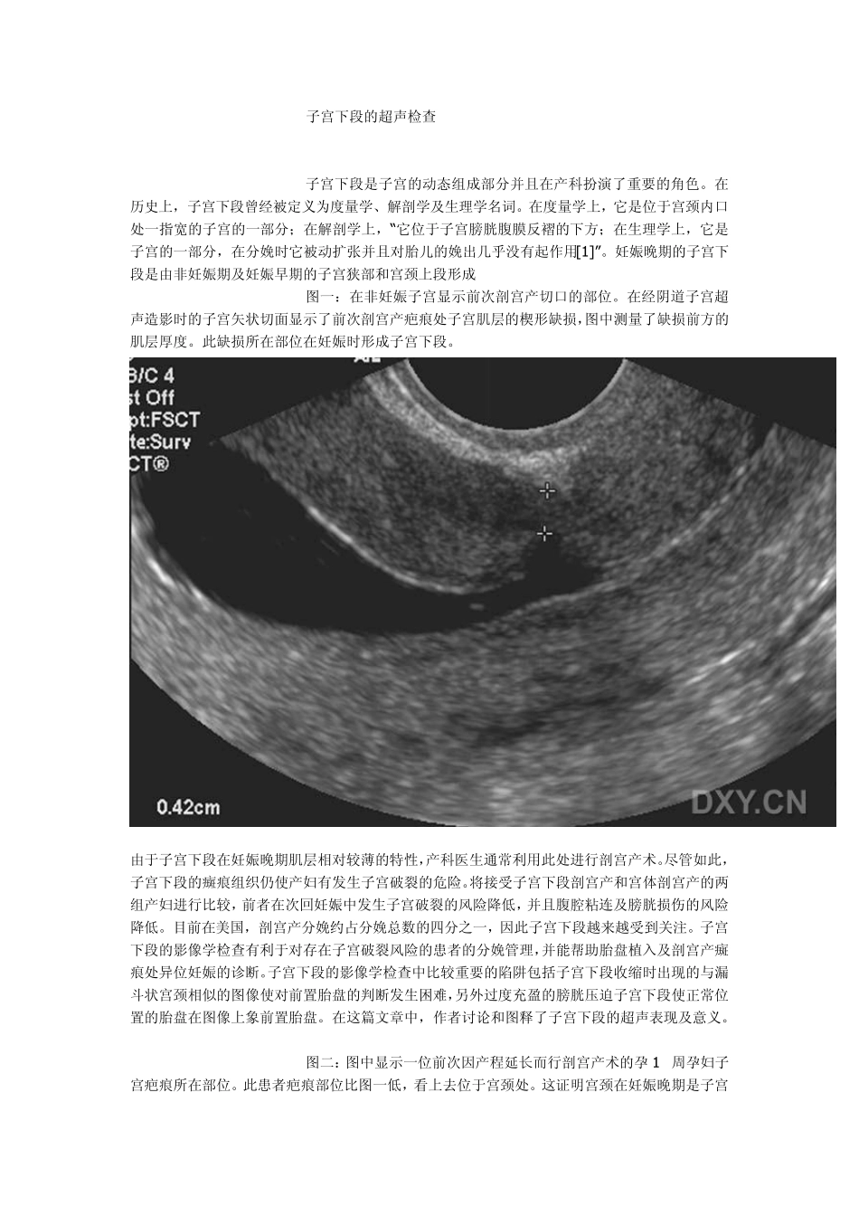 子宫下段的超声检查_第1页