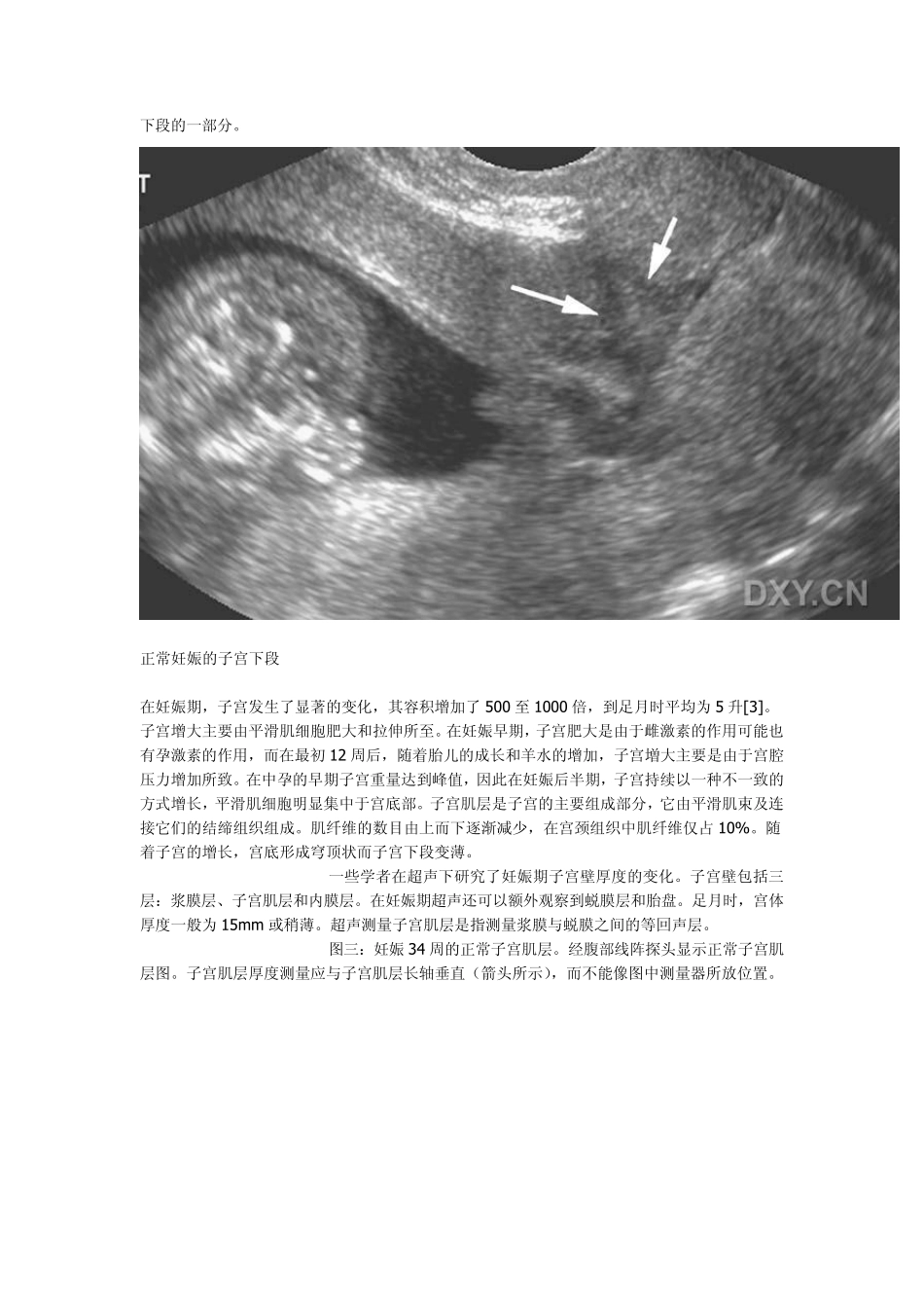 子宫下段的超声检查_第2页
