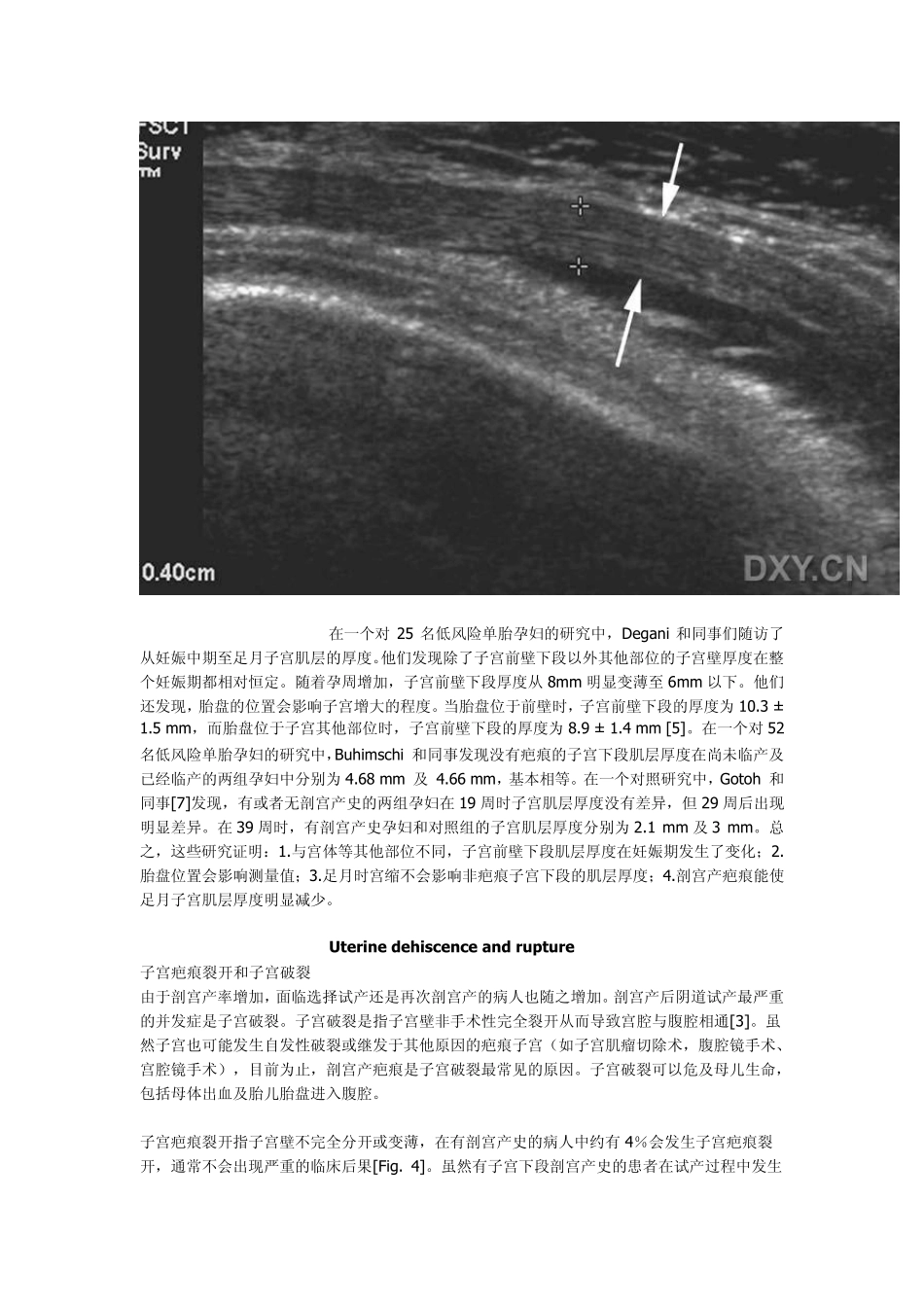 子宫下段的超声检查_第3页
