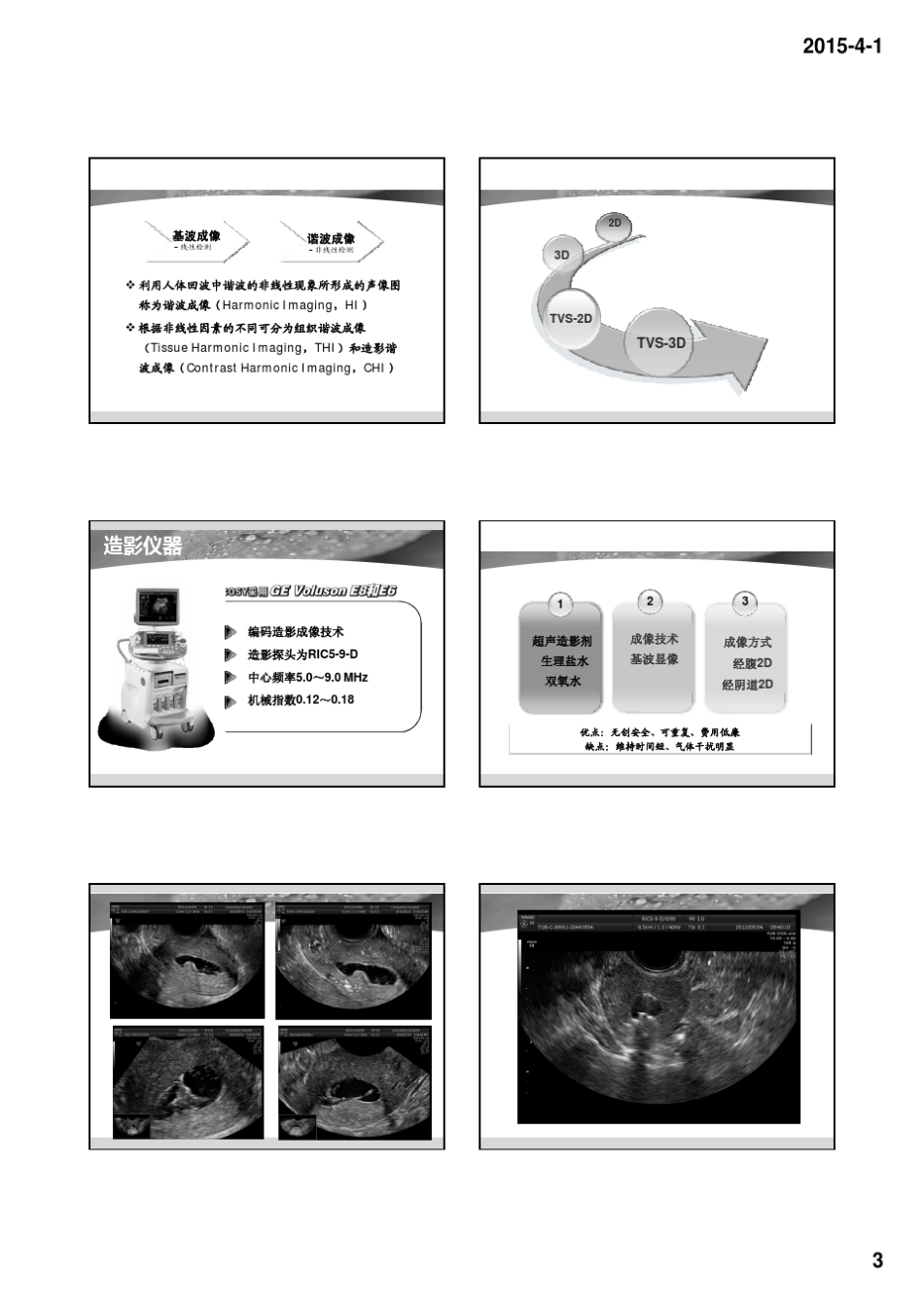 子宫输卵管超声造影_第3页