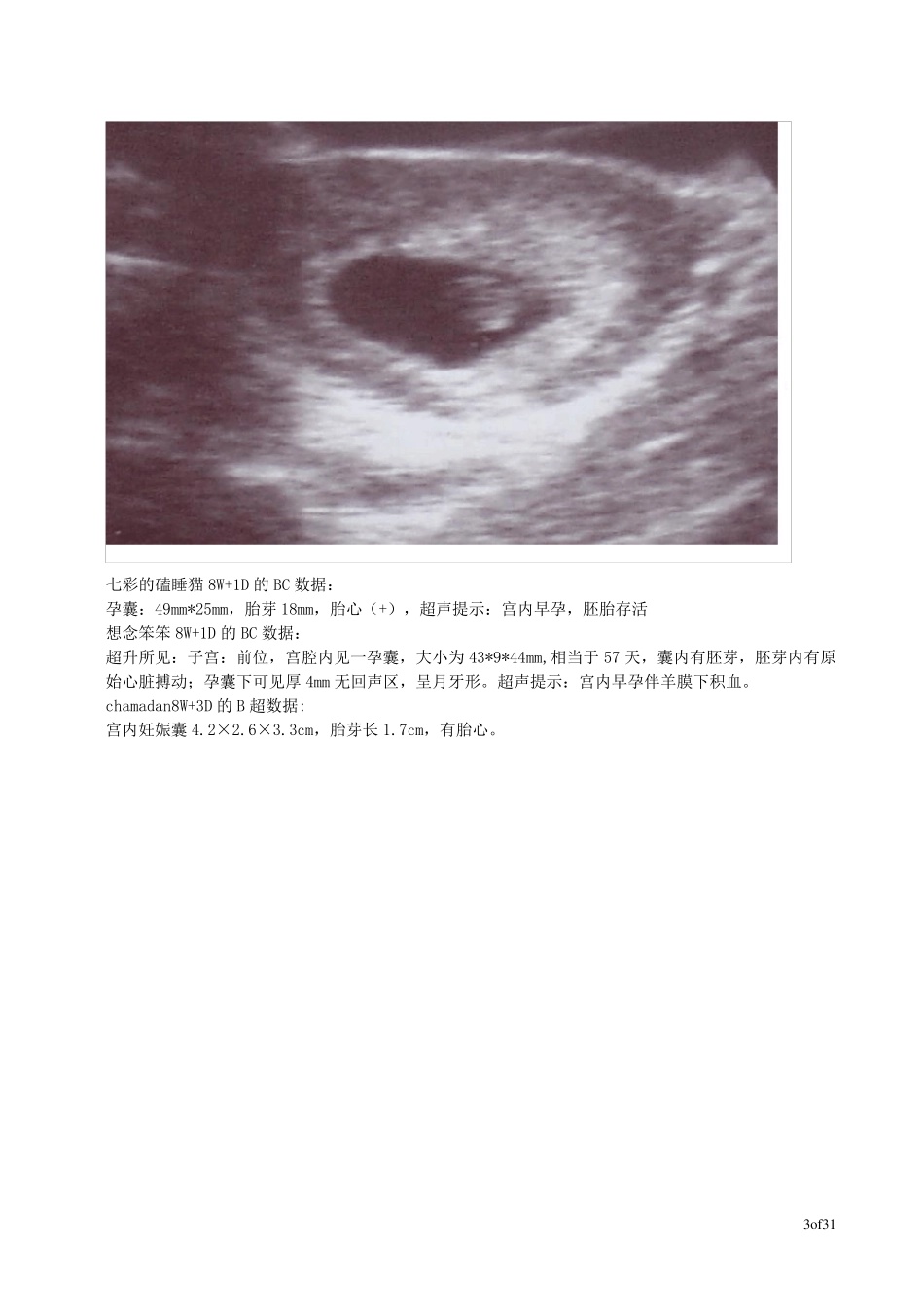 孕早期的B超数据集_第3页
