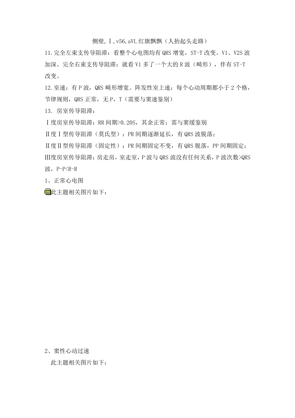 学习心电图必看讲解15例快速判断心电图技巧_第2页
