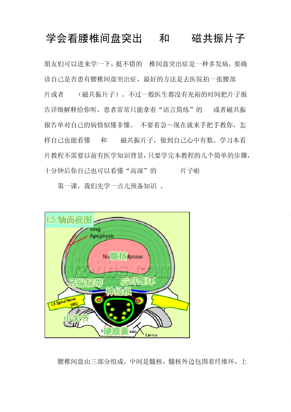 学会看腰椎间盘突出CT和MRI磁共振片子_第1页