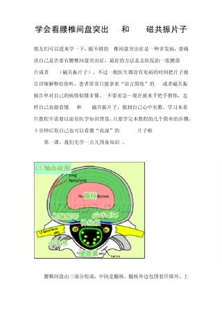 学会看腰椎间盘突出CT和MRI磁共振片子