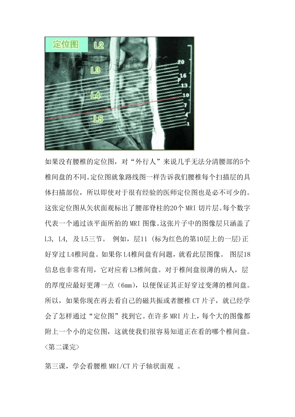学会看腰椎间盘突出CT和MRI磁共振片子的教程_第3页