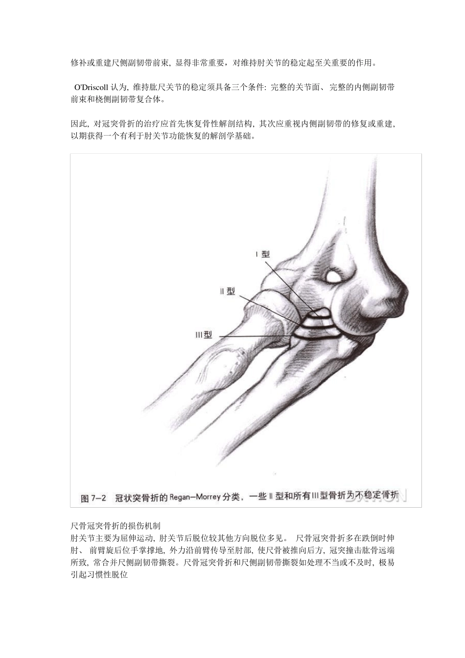 尺骨冠突骨折的分型及治疗_第2页