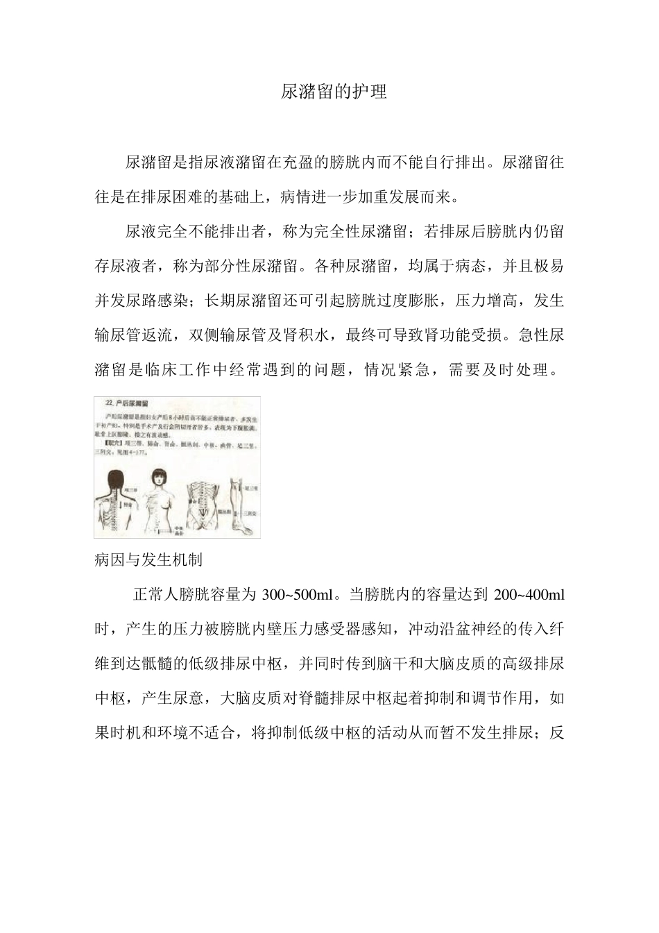 尿潴留的护理_第1页