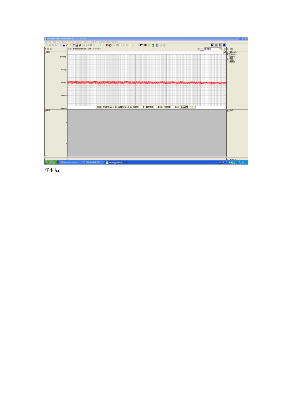 尿生成的影响因素_第2页