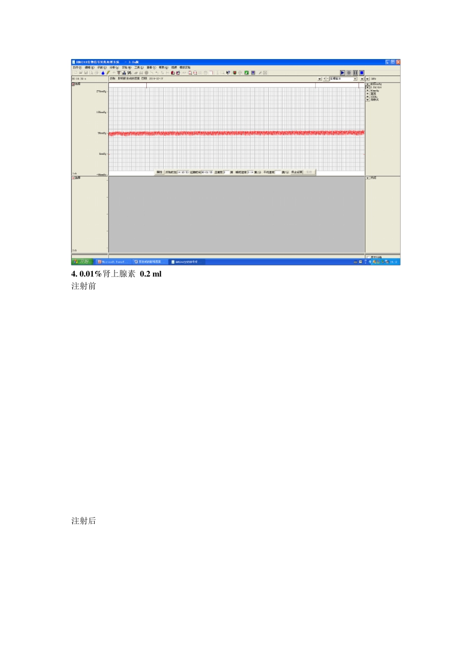 尿生成的影响因素_第3页