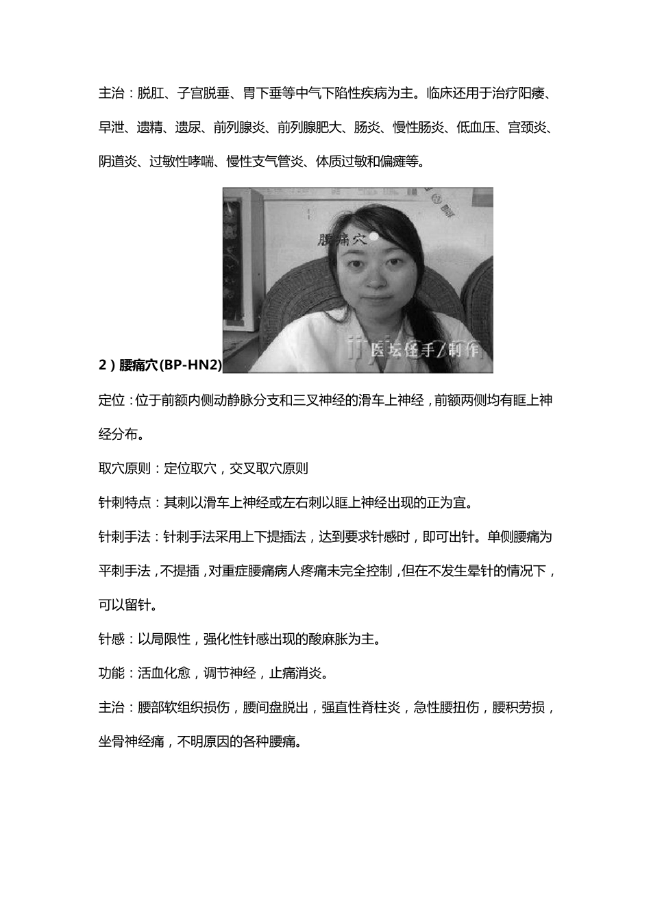 平衡针疗法附穴位图_第2页