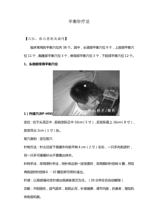 平衡针疗法附穴位图