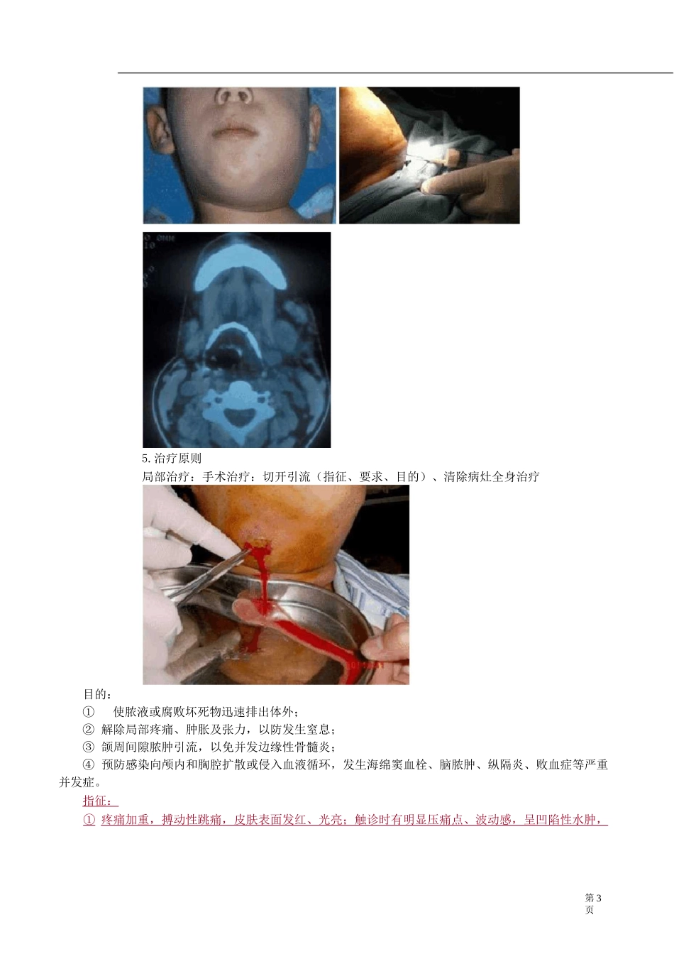 口腔颌面外科学-口腔颌面部感染讲义_第3页