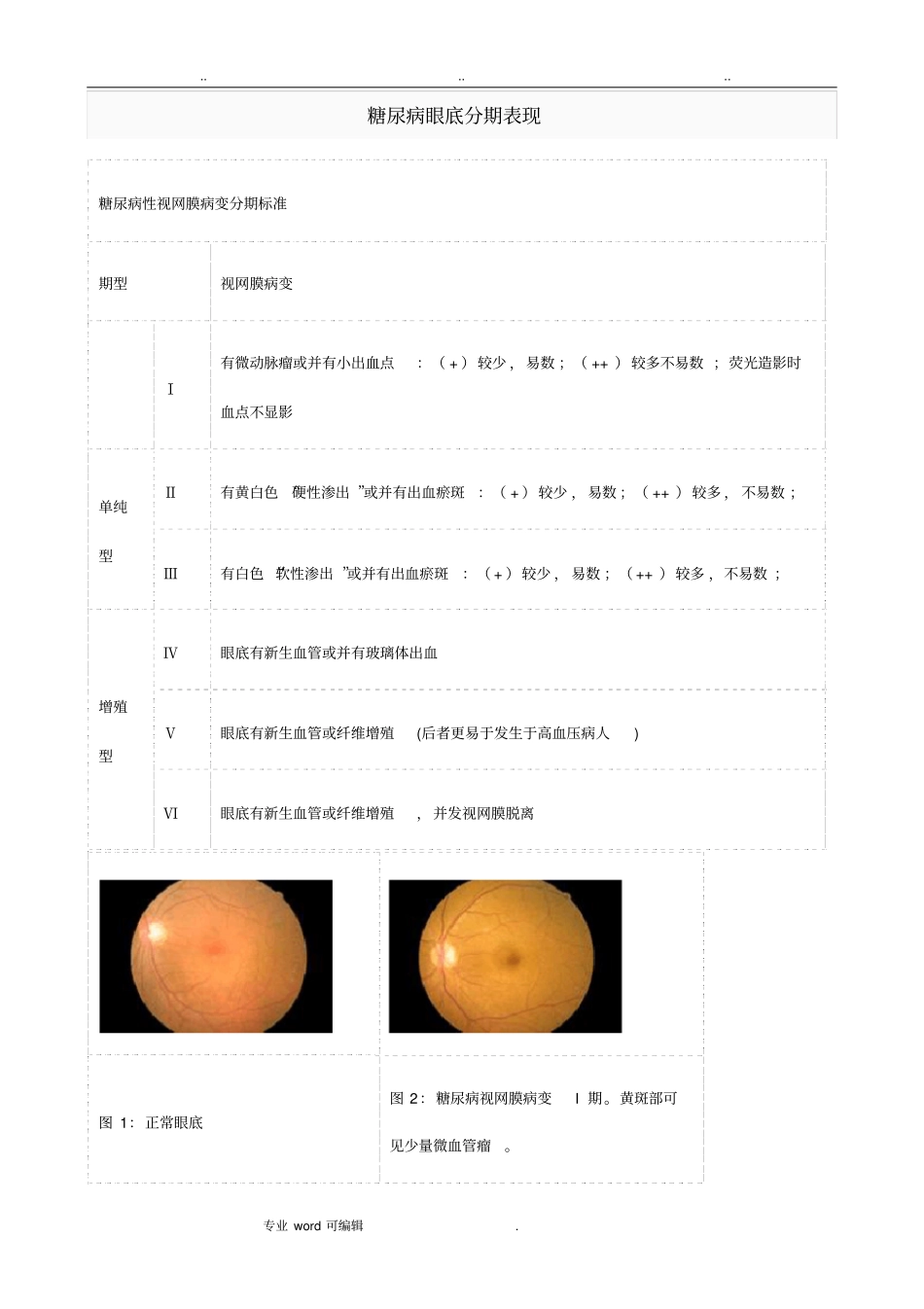 糖尿病眼底分期表现_第1页