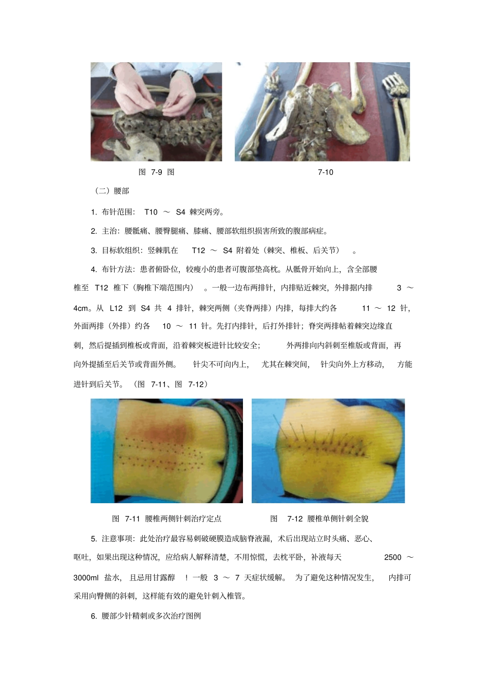 细银针布针方法重点讲义资料_第3页