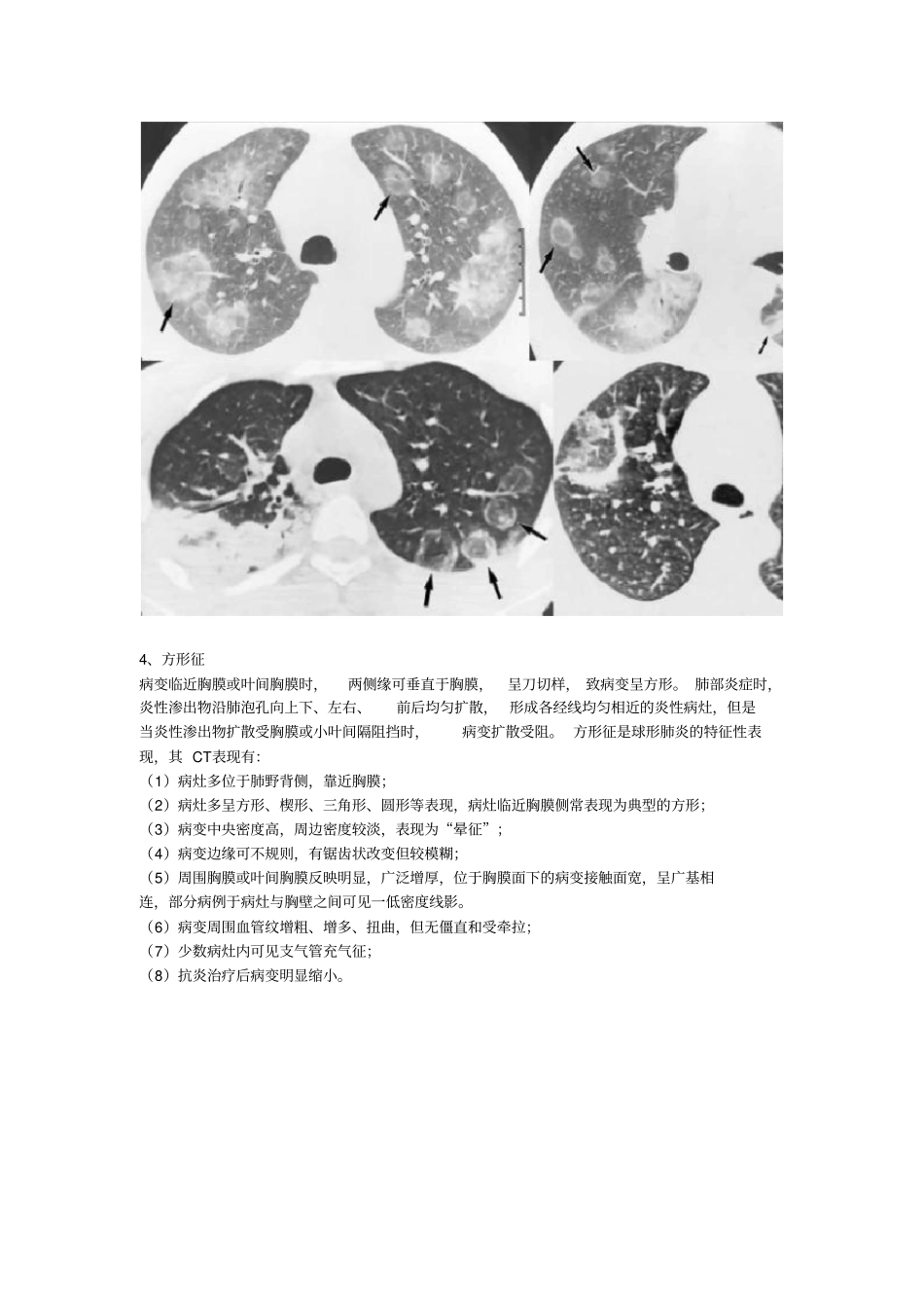 胸部医学影像征象集萃_第3页