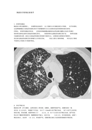 胸部医学影像征象集萃